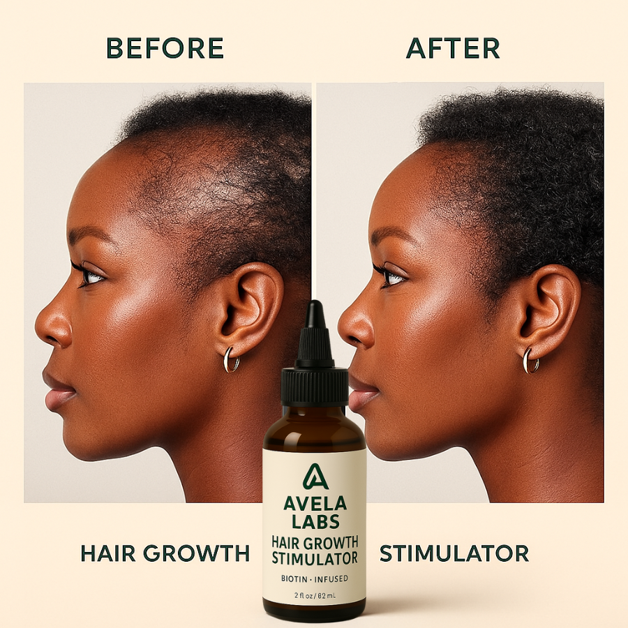 Hair Growth Stimulator | Avela Labs